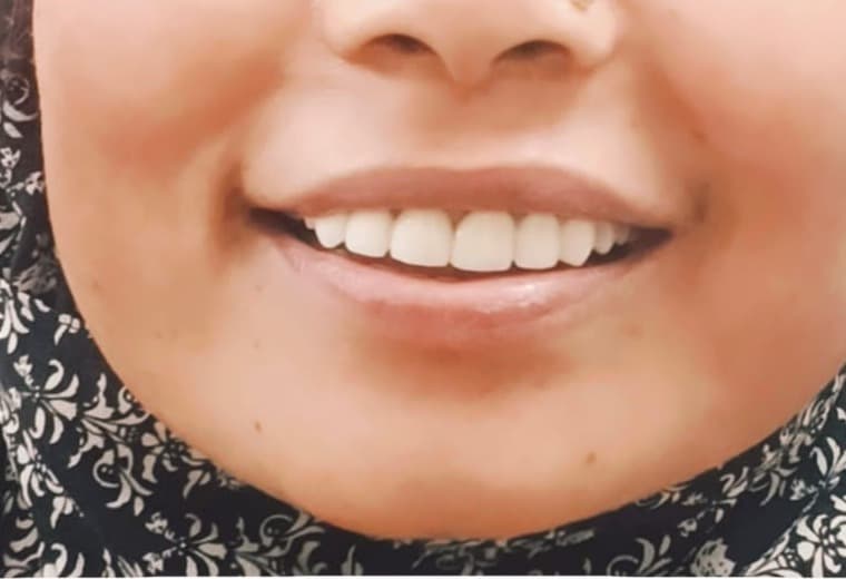 After treatment